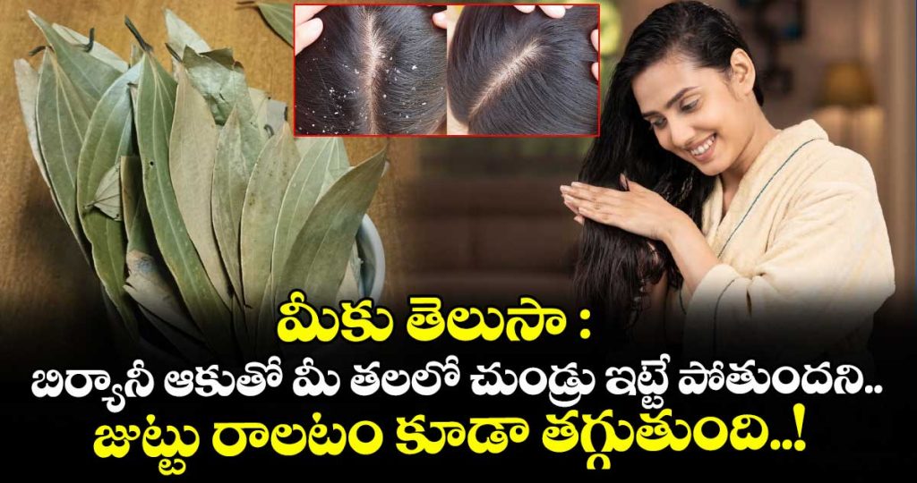 did-you-know-biryani-leaves-can-help-get-rid-of-dandruff-and-reduce-hair-fall_E9VDS4peY5