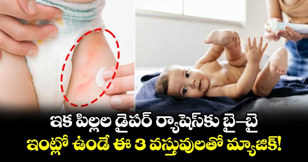 say-goodbye-to-diaper-rashes-works-this-magic-with-these-3-household-items_oDPq1TtVjC