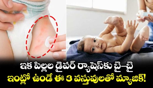 say-goodbye-to-diaper-rashes-works-this-magic-with-these-3-household-items_oDPq1TtVjC