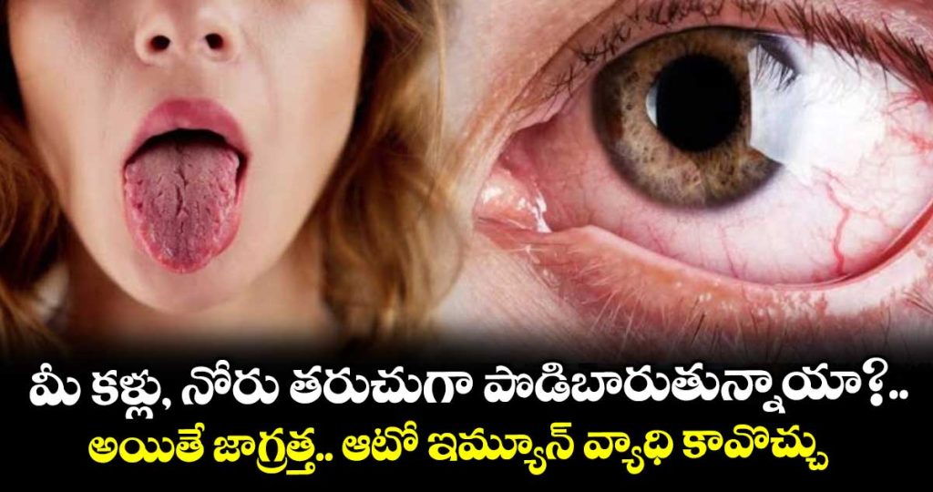 dry-eyes-dry-mouth-could-be-signs-of-an-autoimmune-disease-what-are-5-warning-signs-to-look-out-for_KLTl1oHANi