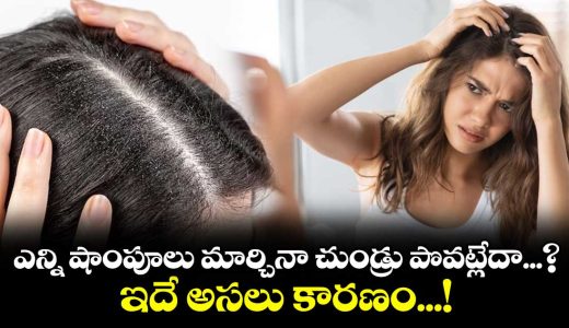 why-your-dandruff-keeps-coming-back-and-what-your-scalp-may-be-trying-to-tell-you_wGS5d9rtKv