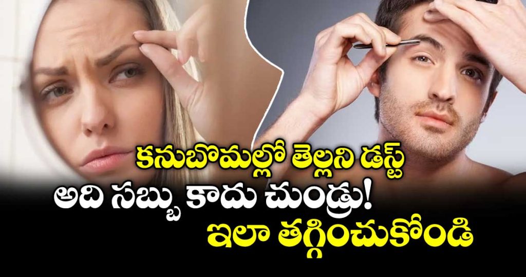 how-to-reduce-dandruff-in-the-eyebrows_HTYBAl8CcJ