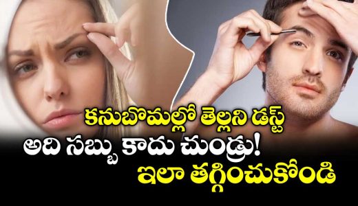 how-to-reduce-dandruff-in-the-eyebrows_HTYBAl8CcJ