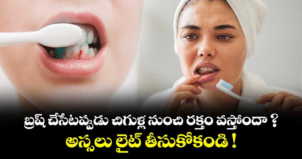 do-your-gums-bleed-while-brushing-do-not-take-it-lightly-at-all_TEl9WcRCVN