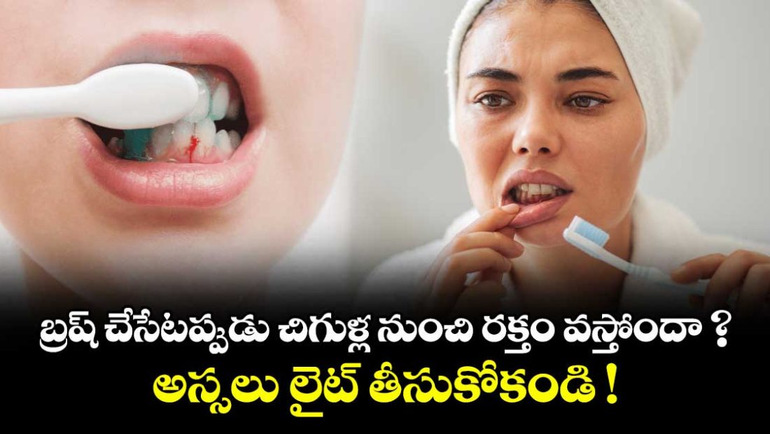 do-your-gums-bleed-while-brushing-do-not-take-it-lightly-at-all_TEl9WcRCVN